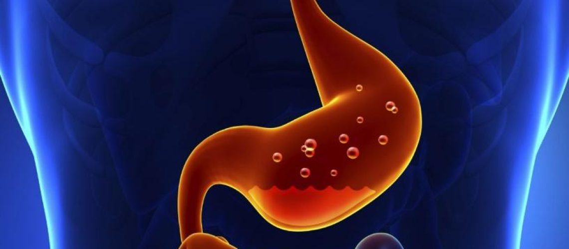 دکتر سوء هاضمه در بندرعباس