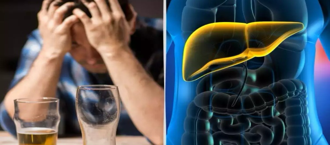 دکتر کبد الکلی در تهران